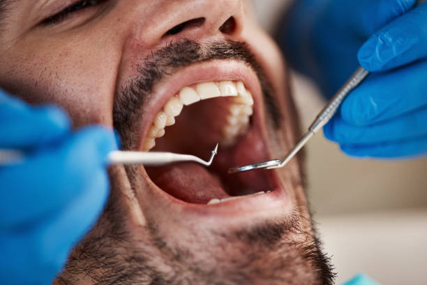 Best Knocked-Out Tooth Emergency  in North Plymouth, MA